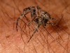 Small Spider on my Arm